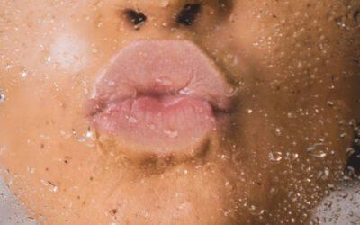 New Client & New Lip Filler Trend: Angel Lips
